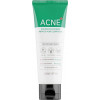 Some By Mi AHA-BHA-PHA 30 Days Miracle Acne Clear Foam - Очищаюча пінка з кислотами