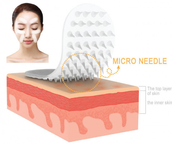 Royal Skin Micro Patch - Гіалуронові мезо-патчі з мікроголками - 3