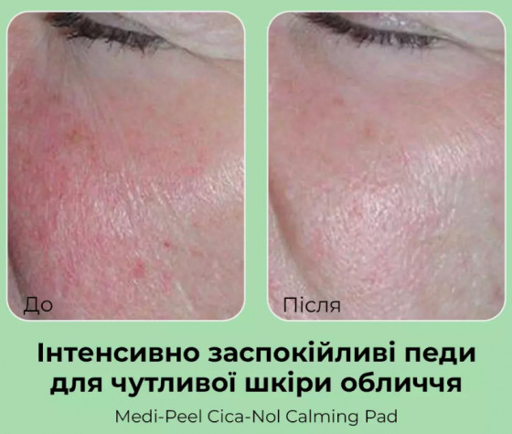 Medi-Peel Phyto Cica-Nol B5 Calming Pad - Заспокійливі пілінг-диски для чутливої ​​шкіри обличчя - 2