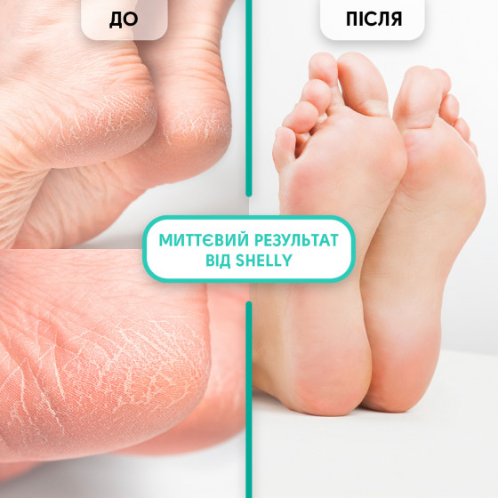 Shelly Gel-keratolytic for Removing Calluses and Corns "Soft blade" - Гель-кератолітик для видалення мозолів та натоптишів "М'яке лезо" - 4