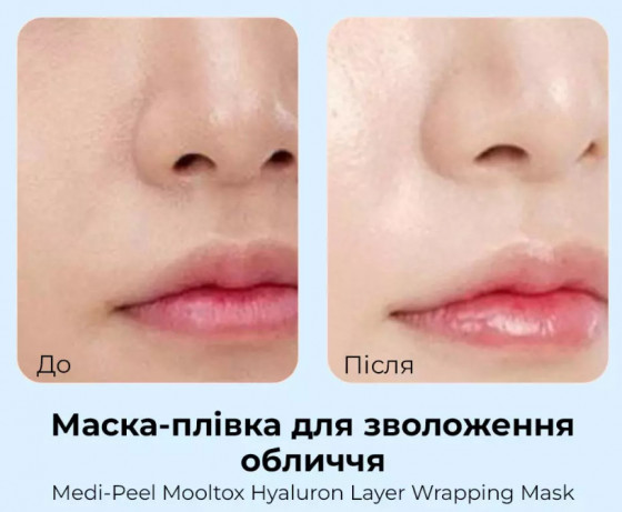 Medi-Peel Hyaluronic Acid Layer Mooltox Wrapping Mask - Зволожуюча маска-плівка для обличчя - 2